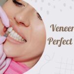 Veneers for Perfect Teeth