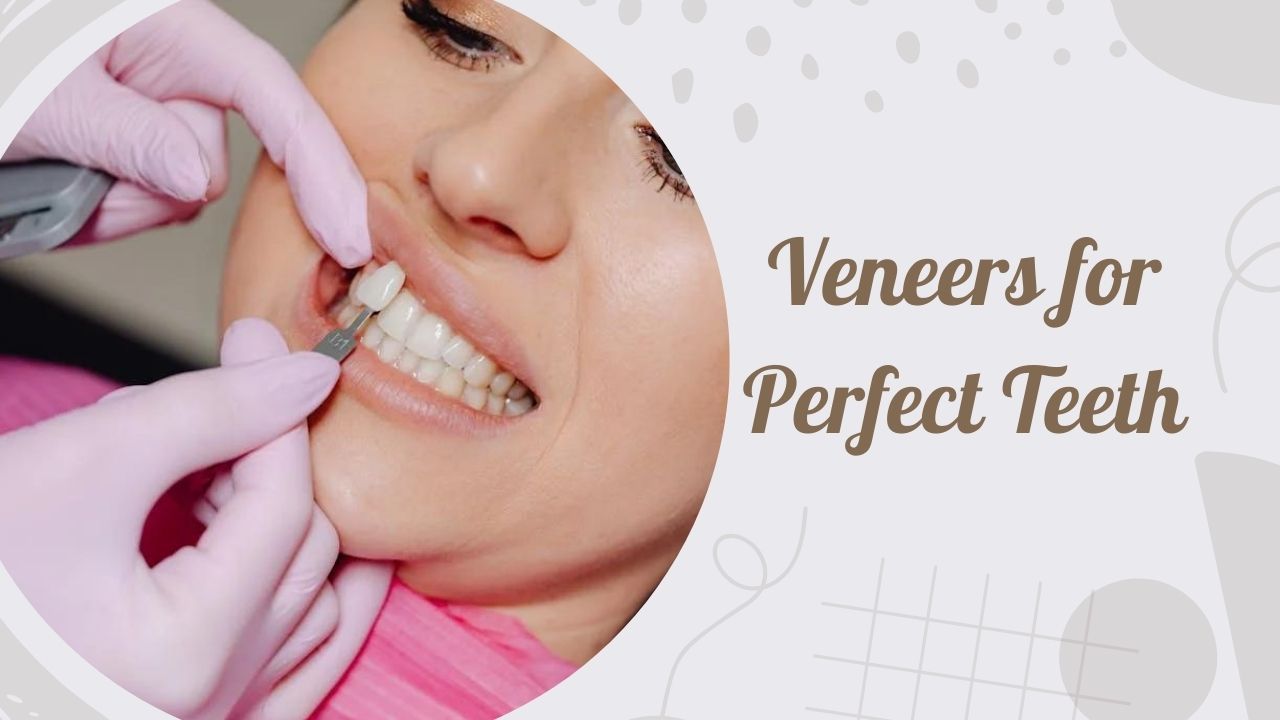 Veneers for Perfect Teeth